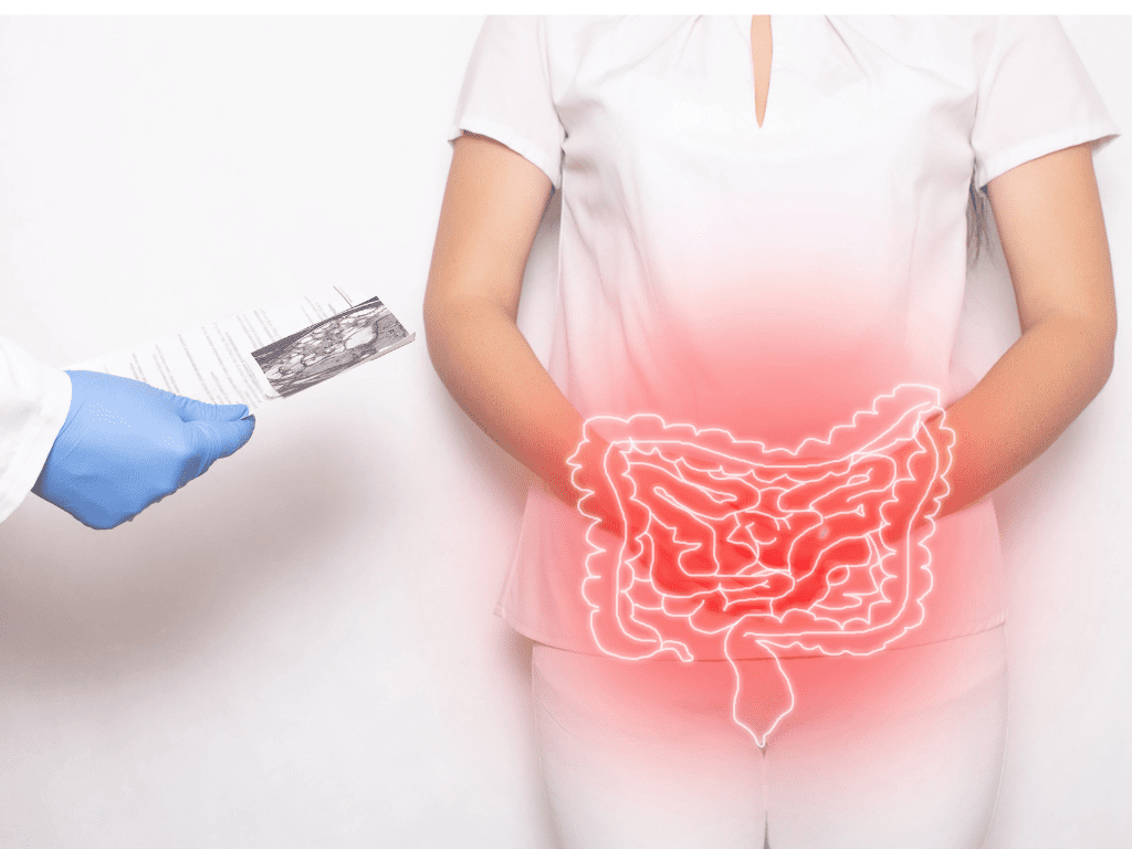 Read more about the article Prevenindo o Câncer de Intestino: A Importância da Colonoscopia Regular